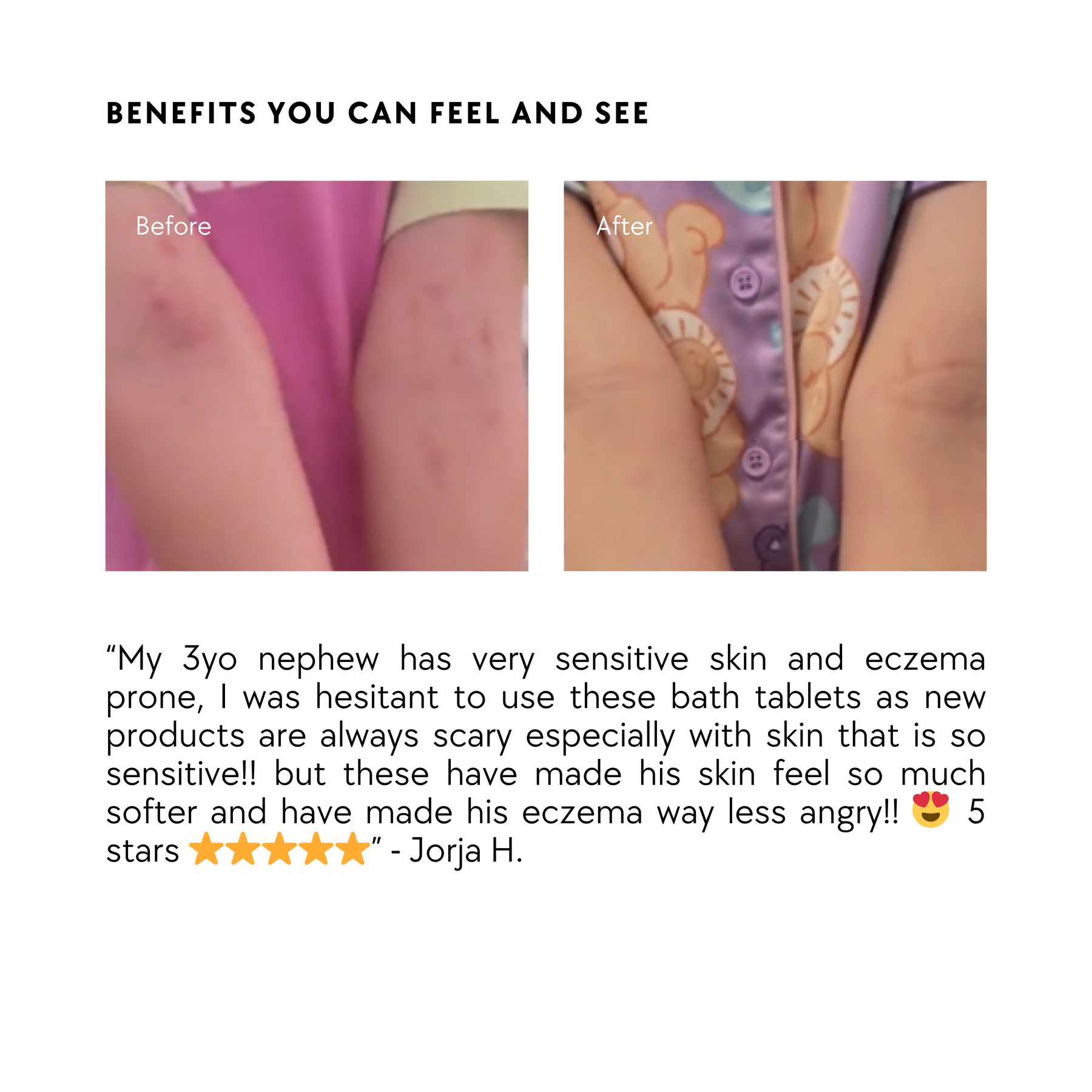 The Essential Silver Bundle