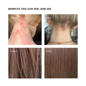 The Scalp Therapy Bundle - Gold